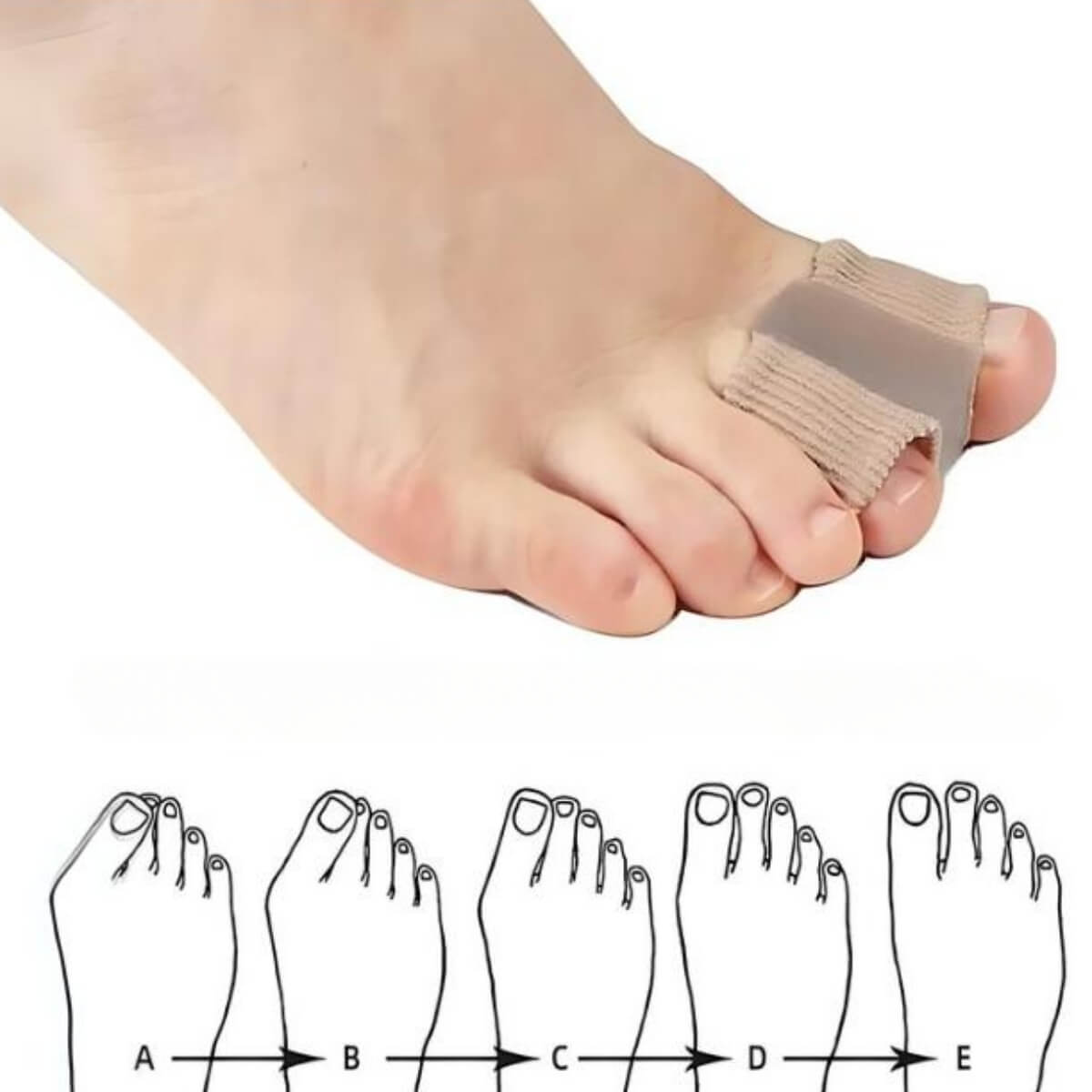 FodKomfort™ - Comfortabele Hallux Valgus-korrektor (1+1 GRATIS)